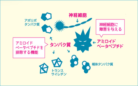 MCIスクリーニングとは